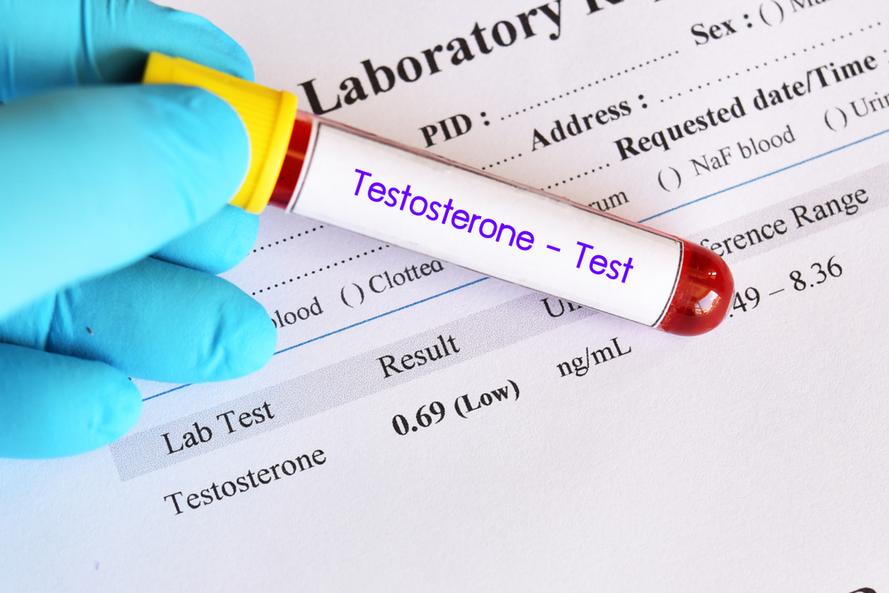 how-do-i-know-if-my-testosterone-level-is-low-male-ultracore-blog