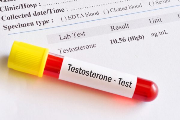 Can You Have Too Much Testosterone? - Male UltraCore Blog